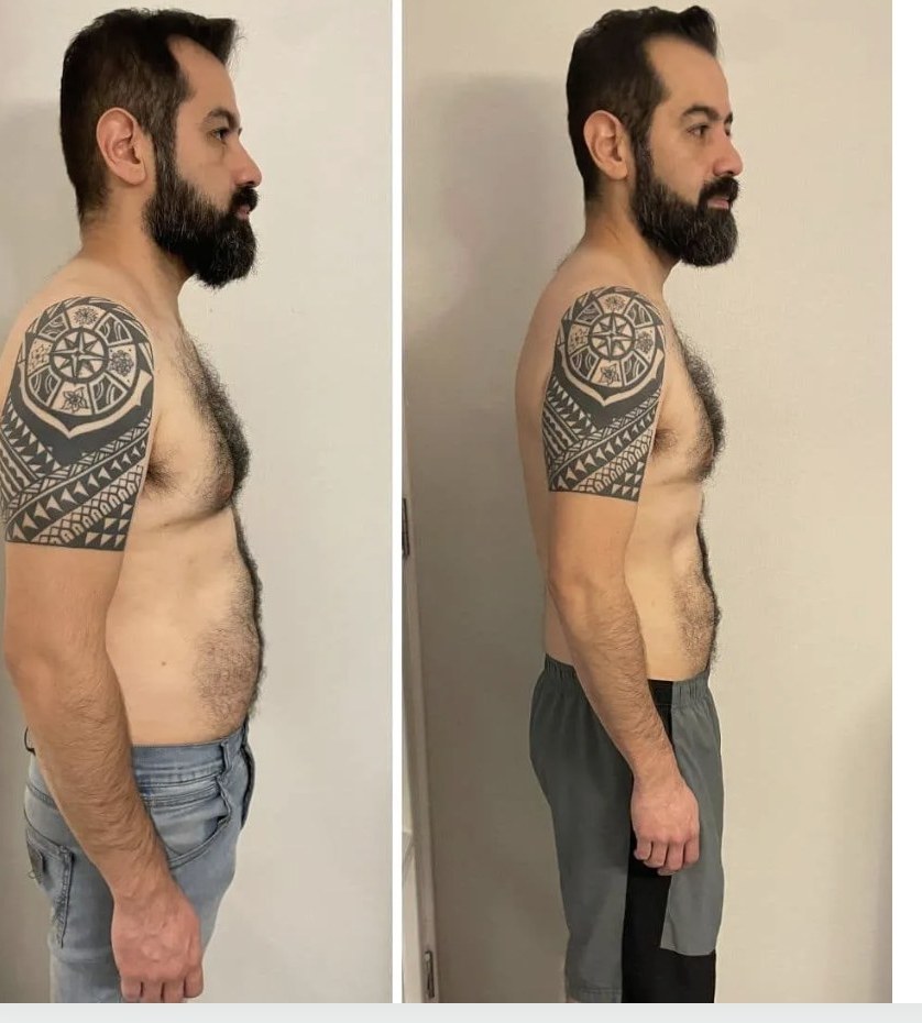 Óscar Mardones, antes y después con KinuFit